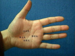 手纹健康线与疾病真的有关系吗